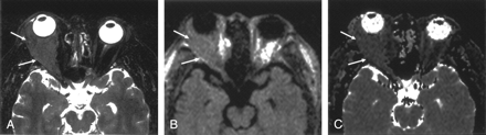 Fig 4.