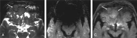 Fig 5.