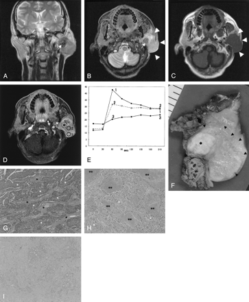 Fig 1.