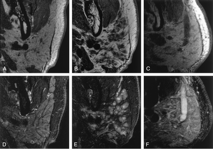 Fig 2.