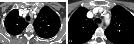 Fig 1.
