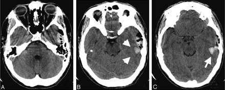 Fig 1.