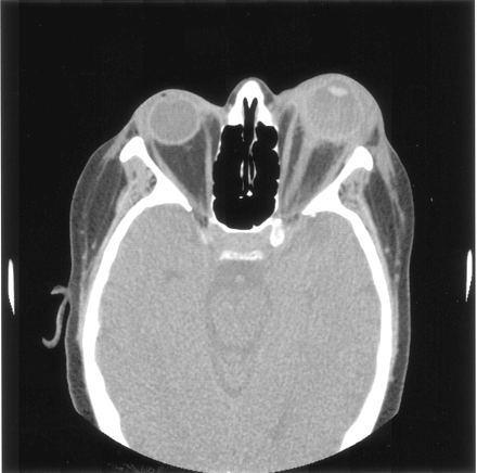 Fig 2.