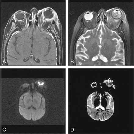 Fig 3.