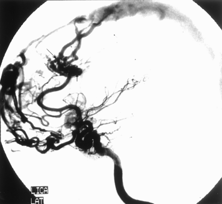 Fig 4.