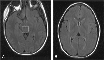 Fig 1.
