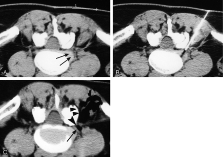 Fig 2.