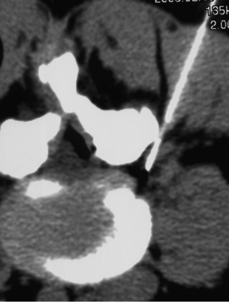 Fig 3.