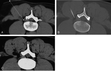 Fig 4.