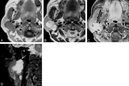Fig 2.