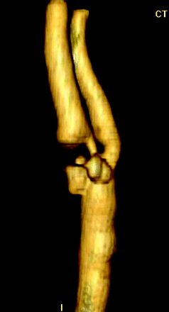 Fig 1.