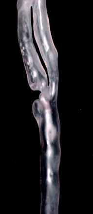 Fig 3.