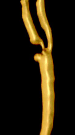 Fig 4.