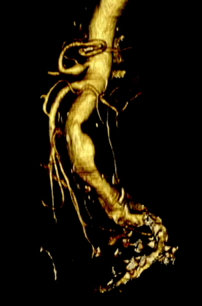 Fig 5.