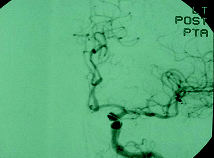 Fig 3.