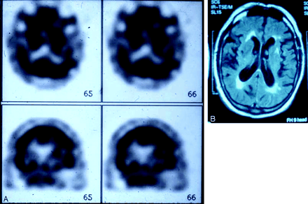Fig 4.