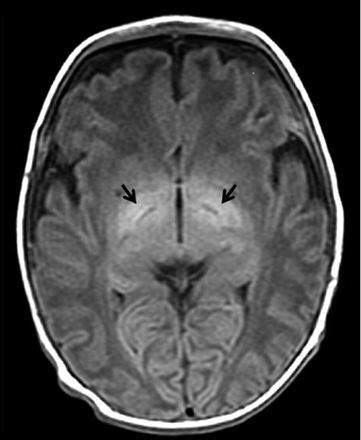 Fig 1.