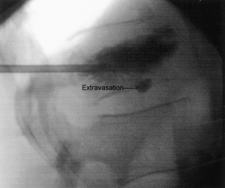 Fig 1.