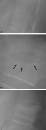 Fig 4.