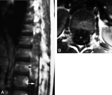 Fig 5.