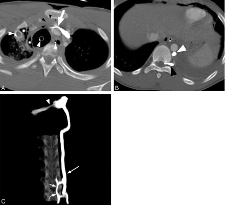 Fig 1.