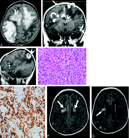 Fig 1.