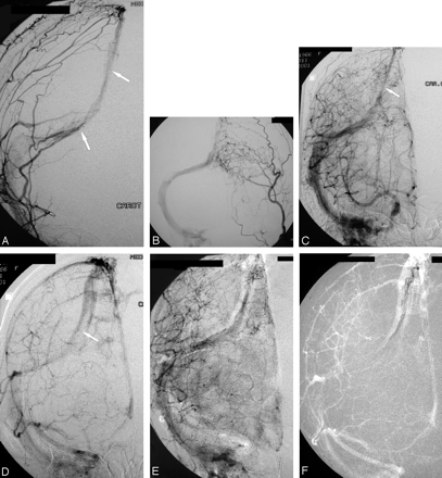 Fig 1.