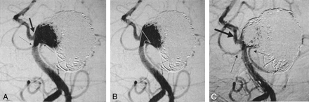 Fig 4.
