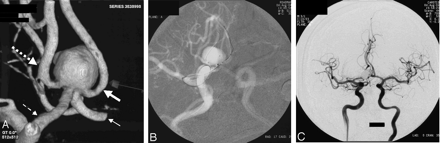 Fig 2.