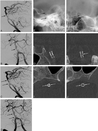 Fig 3.