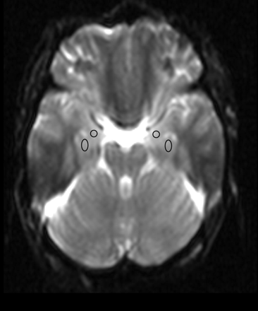 Fig 1.