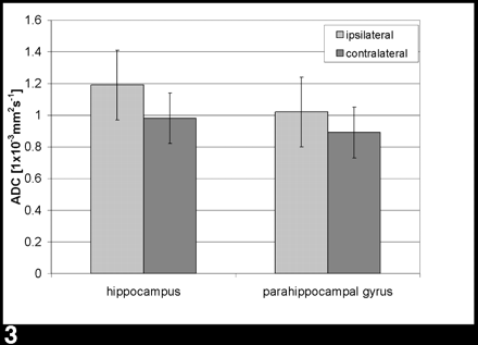 Fig 3.
