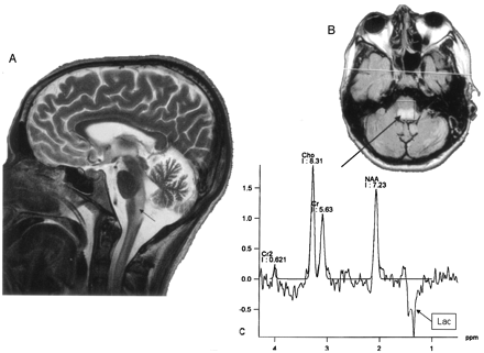 Fig 4.