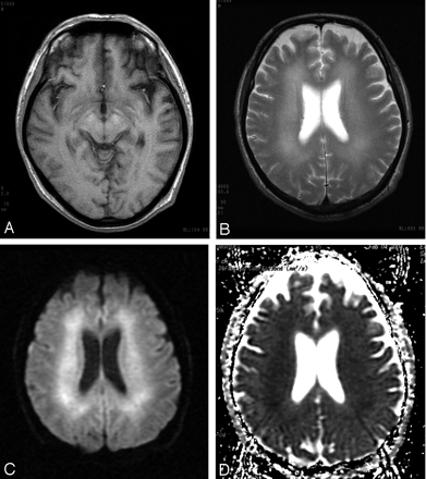Fig 3.