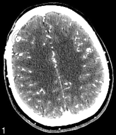 Fig 1.