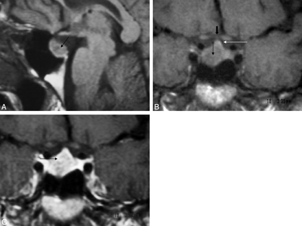 Fig 3.