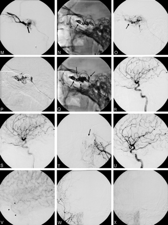 Fig 3.