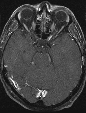 Fig 1.
