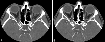 Fig 2.
