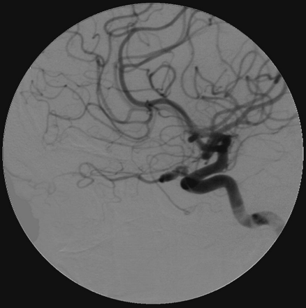 Fig 3.