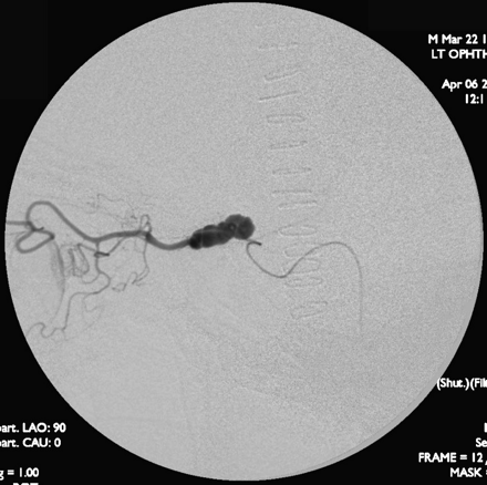 Fig 4.