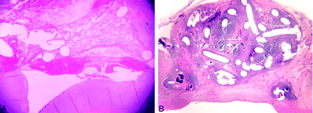 Fig 3.