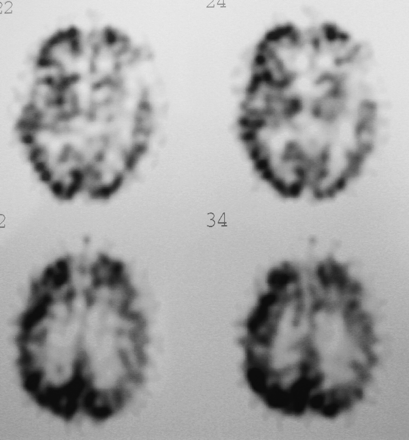 Fig 3.