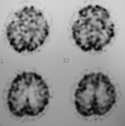 Fig 4.