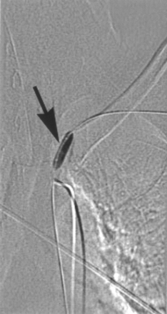 Fig 4.