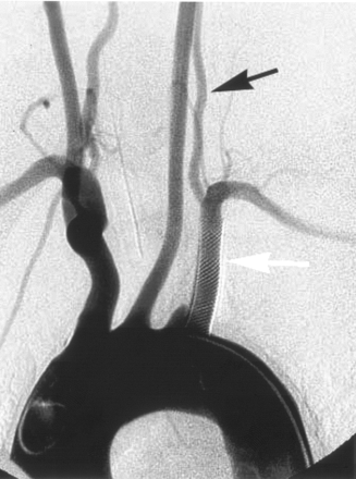 Fig 5.