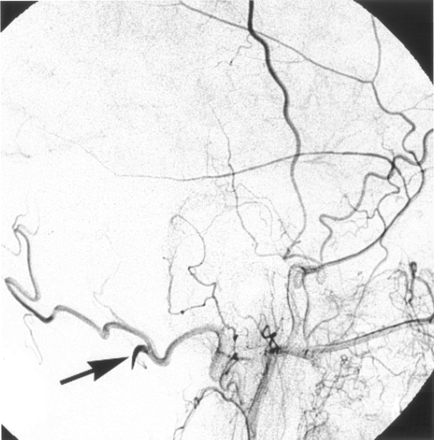 Fig 6.