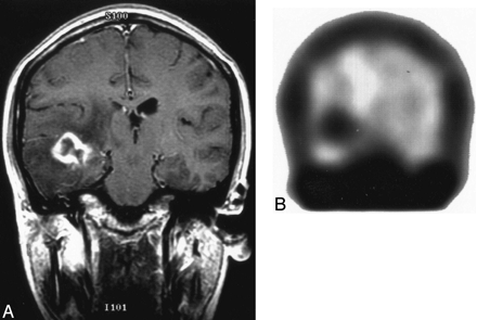 Fig 1.