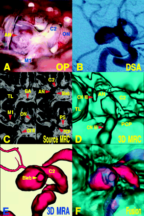 Fig 2.