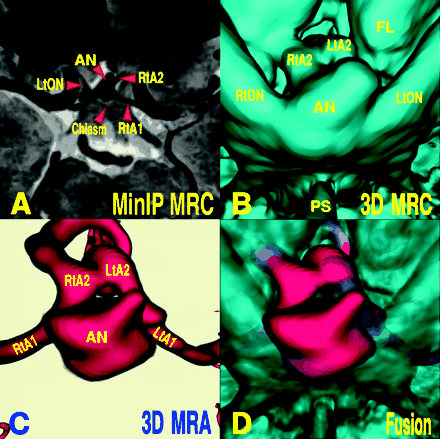 Fig 3.